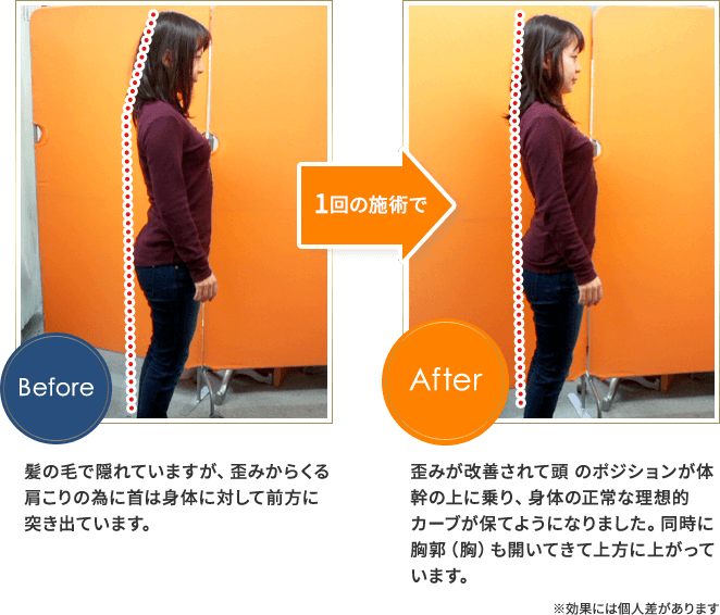 肩が楽になりました。